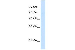 WB Suggested Anti-LETM1 Antibody Titration:  5. (LETM1 抗体  (Middle Region))