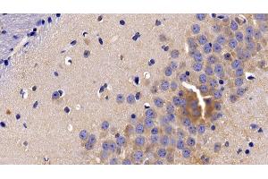 Detection of TNFR1 in Mouse Cerebrum Tissue using Polyclonal Antibody to Tumor Necrosis Factor Receptor 1 (TNFR1)