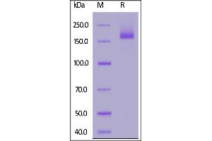 SDS-PAGE (SDS) image for SARS-CoV-2 Spike (Super Stable Trimer) protein (His tag) (ABIN6953299)