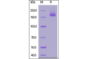 SARS-CoV-2 S protein, His Tag, Super stable trimer on  under reducing (R) condition.