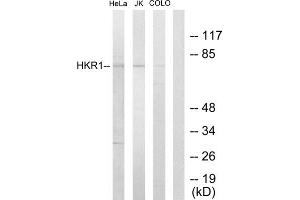 Western blot analysis of extracts from HeLa cells, Jurkat cells and COLO205 cells, using HKR1 antibody. (HKR1 抗体  (Internal Region))