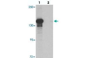 Western blot analysis of KDM6B in K-562 cell lysate with KDM6B polyclonal antibody  at 0. (Kdm6b 抗体  (N-Term))