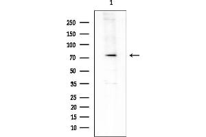 anti-rho GTPase Activating Protein 18 (ARHGAP18) (Internal Region) antibody