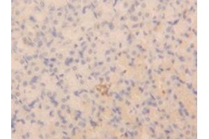 Detection of NPPA in Rat Stomach Tissue using Polyclonal Antibody to Natriuretic Peptide Precursor A (NPPA)