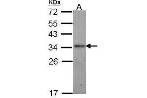 WB Image Sample (30 ug of whole cell lysate) A: A431 , 12% SDS PAGE antibody diluted at 1:1000 (IL-24 抗体  (C-Term))