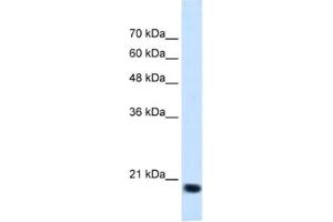 Western Blotting (WB) image for anti-Signal Sequence Receptor, beta (Translocon-Associated Protein Beta) (SSR2) antibody (ABIN2462852) (SSR2 抗体)
