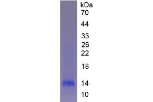 SDS-PAGE analysis of Human Fibrinogen alpha Protein. (FGA 蛋白)
