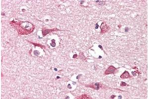 Anti-PLCG1 antibody IHC staining of human brain, cortex. (Phospholipase C gamma 1 抗体)