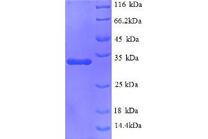 SDS-PAGE (SDS) image for Mucin 5AC, Oligomeric Mucus/gel-Forming (MUC5AC) (AA 2452-2721), (partial) protein (His tag) (ABIN5713076)