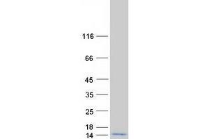 Western Blotting (WB) image for Ubiquitin A-52 Residue Ribosomal Protein Fusion Product 1 (UBA52) (Transcript Variant 2) protein (Myc-DYKDDDDK Tag) (ABIN2734765)
