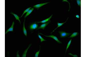 Immunofluorescence staining of Hela cells with ABIN7153745 at 1:133, counter-stained with DAPI. (GMDS 抗体  (AA 243-346))