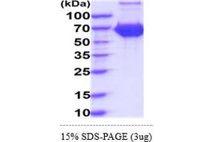 SDS-PAGE (SDS) image for Interleukin 7 Receptor (IL7R) (AA 21-239) protein (hIgG-His-tag) (ABIN6388135)
