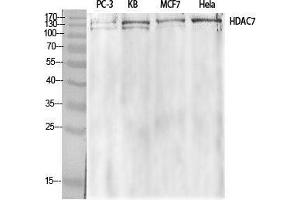 Western Blot (WB) analysis of specific cells using HDAC7 Polyclonal Antibody. (HDAC7 抗体  (Tyr721))