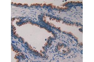IHC-P analysis of prostate gland tissue, with DAB staining. (PLAA 抗体  (AA 534-792))