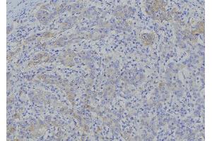 ABIN6276937 at 1/100 staining Human gastric tissue by IHC-P.