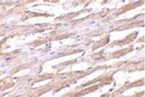 Immunohistochemistry of Unc93b in human heart with this product at 2.