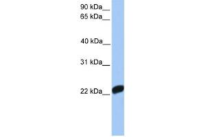 WB Suggested Anti-F10 Antibody Titration:  0.