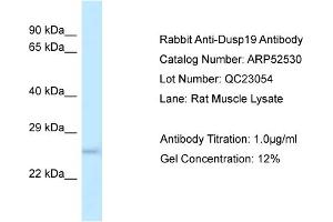 Western Blotting (WB) image for anti-Dual Specificity Phosphatase 19 (DUSP19) (N-Term) antibody (ABIN2784969) (DUSP19 抗体  (N-Term))