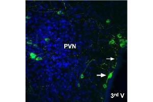 Immunohistochemistry (IHC) image for anti-Angiotensin II Receptor, Type 2 (AGTR2) (AA 21-35), (Extracellular) antibody (Atto 488) (ABIN7042926)