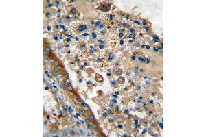 Immunohistochemistry (Paraffin-embedded Sections) (IHC (p)) image for anti-Leucine Rich Repeat Containing 32 (LRRC32) (AA 234-260) antibody (ABIN390588)
