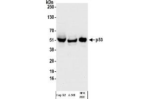 Western Blotting (WB) image for anti-Tumor Protein P53 (TP53) (AA 20-25) antibody (ABIN7455068)