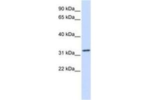 Image no. 1 for anti-Tropomyosin alpha-1 Chain (TM7) (C-Term) antibody (ABIN6743064) (TM7 抗体  (C-Term))