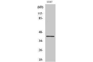 Western Blotting (WB) image for anti-GATA Binding Protein 1 (Globin Transcription Factor 1) (GATA1) (pSer310) antibody (ABIN3182019) (GATA1 抗体  (pSer310))