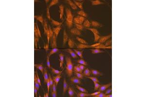 Immunofluorescence analysis of C6 cells using U Rabbit mAb (ABIN7271211) at dilution of 1:100 (40x lens). (UAP1 抗体)