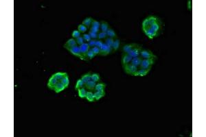 Immunofluorescence (IF) image for anti-ArfGAP with RhoGAP Domain, Ankyrin Repeat and PH Domain 1 (ARAP1) (AA 69-344) antibody (ABIN7144564)