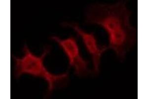 ABIN6269089 staining HeLa by IF/ICC.