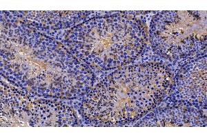 Detection of PRDX2 in Mouse Testis Tissue using Polyclonal Antibody to Peroxiredoxin 2 (PRDX2) (Peroxiredoxin 2 抗体  (AA 6-164))