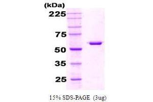 Figure annotation denotes ug of protein loaded and % gel used. (Chaperonin GroEL (GroEL) 蛋白)