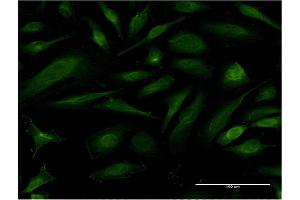 Immunofluorescence of monoclonal antibody to EIF1AY on HeLa cell. (EIF1AY 抗体  (AA 31-120))