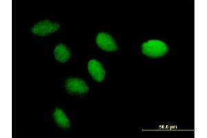 Immunofluorescence of purified MaxPab antibody to CENPK on HeLa cell. (CENPK 抗体  (AA 1-269))