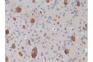 Immunohistochemistry (IHC) image for anti-Sprouty Homolog 1, Antagonist of FGF Signaling (SPRY1) (AA 112-303) antibody (ABIN7439549)