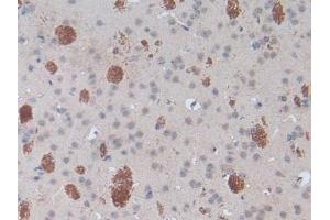 Detection of SPRY1 in Mouse Brain Tissue using Polyclonal Antibody to Sprouty Homolog 1 (SPRY1) (SPRY1 抗体  (AA 112-303))
