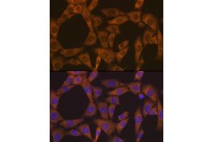 Immunofluorescence analysis of NIH-3T3 cells using CAD Rabbit mAb (ABIN7266064) at dilution of 1:100 (40x lens). (CAD 抗体)