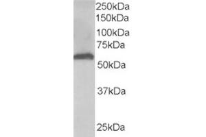 Western Blotting (WB) image for anti-Formiminotransferase Cyclodeaminase (FTCD) (N-Term) antibody (ABIN2465215) (FTCD 抗体  (N-Term))