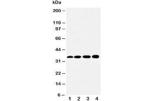 Western blot testing of HSD17B1 antibody and Lane 1:  rat kidney;  2: rat liver;  3: 293T;  4: HeLa cell lysate (HSD17B1 抗体  (AA 29-43))