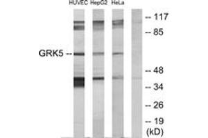 Western blot analysis of extracts from HeLa/HepG2/HuvEc cells, using GRK5 Antibody. (GRK5 抗体  (AA 351-400))