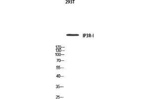 Western Blot (WB) analysis of 293T using IP3R-I antibody. (ITPR1 抗体)
