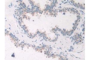 Immunohistochemistry (IHC) image for anti-Solute Carrier Family 12 (Sodium/Chloride Transporters), Member 3 (SLC12A3) (AA 867-1024) antibody (ABIN7441745)