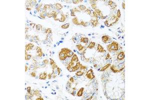 Immunohistochemistry of paraffin-embedded human stomach using CCL2 antibody at dilution of 1:100 (40x lens). (CCL2 抗体)