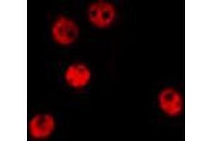ABIN6274374 staining HepG2 by IF/ICC. (TSC22D1 抗体  (C-Term))