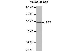 Western Blotting (WB) image for anti-Interferon Regulatory Factor 4 (IRF4) (AA 150-350) antibody (ABIN1680506) (IRF4 抗体  (AA 150-350))