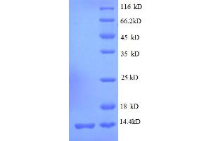 SDS-PAGE (SDS) image for Ribosomal Protein S19 (RPS19) (AA 2-92) protein (His tag) (ABIN5712600) (RPS19 Protein (AA 2-92) (His tag))
