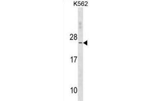 TNNC2 Antibody (C-term) (ABIN1881894 and ABIN2838656) western blot analysis in K562 cell line lysates (35 μg/lane). (TNNC2 抗体  (C-Term))