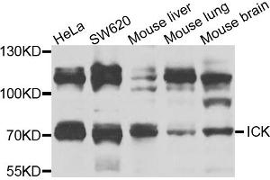 Western blot analysis of extracts of various cell lines, using ICK antibody (ABIN5974764) at 1/1000 dilution. (ICK 抗体)