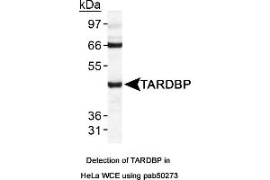 Image no. 1 for anti-TAR DNA Binding Protein (TARDBP) (AA 350-414), (C-Term) antibody (ABIN363582) (TARDBP 抗体  (C-Term))