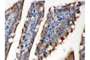 Immunohistochemistry (Paraffin-embedded Sections) (IHC (p)) image for anti-Sulfotransferase Family, Cytosolic, 2B, Member 1 (SULT2B1) (AA 190-218), (Middle Region) antibody (ABIN3043414)